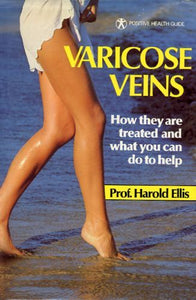 Varicose Veins: How They Are Treated And What You Can Do To Help (Positive Health Guide) - maddybooks